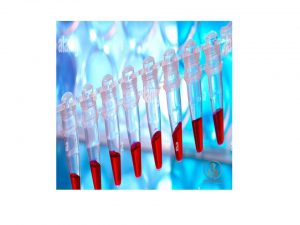 حساس ترین روش برای تشخیص  (CML ،PCR (RT-PCR برای RNA پیام رسان (BCR/ABL (mRNA است که می تواند یک سلول CML را در حدود 100 تا 1 میلیون سلول تشخیص دهد. در این روش می توان از خون محیطی به جای مغز استخوان برای نظارت استفاده کرد، زیرا همبستگی خوبی بین mRNA ژن BCR/ABL در مغز استخوان و خون محیطی وجود دارد.